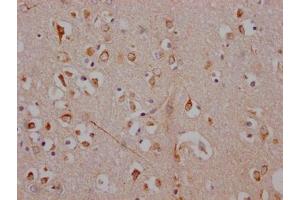IHC image of ABIN7127325 diluted at 1:100 and staining in paraffin-embedded human brain tissue performed on a Leica BondTM system. (Recombinant ADORA1 抗体)