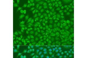 Immunofluorescence analysis of U2OS cells using BIRC3 Polyclonal Antibody at dilution of 1:100.