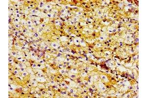 Immunohistochemistry of paraffin-embedded human adrenal gland tissue using ABIN7158300 at dilution of 1:100 (LTA4H 抗体  (AA 107-311))