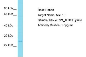 Host: Rabbit Target Name: MYL10 Sample Type: 721_B Whole Cell lysates Antibody Dilution: 1. (MYL10 抗体  (N-Term))
