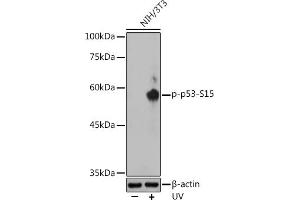 Western blot analysis of extracts of NIH/3T3 cells, using Phospho-p53-S15 antibody ( ABIN3023600, ABIN3023601, ABIN3023602 and ABIN6225458) at 1:500 dilution. (p53 抗体  (pSer15))