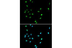 Immunofluorescence analysis of A549 cells using RUNX1 antibody.