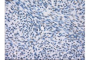 Immunohistochemical staining of paraffin-embedded pancreas tissue using anti-FCGR2A mouse monoclonal antibody. (FCGR2A 抗体)