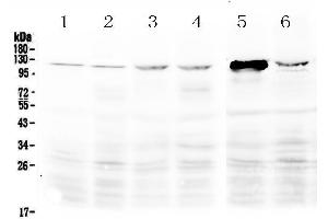 Western blot analysis of DDX58 using anti-DDX58 antibody . (DDX58 抗体  (AA 871-925))