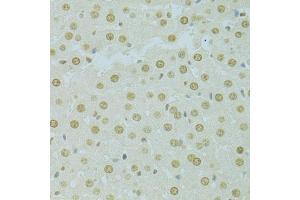 Immunohistochemistry of paraffin-embedded rat liver using RCC1 antibody (ABIN5973761) at dilution of 1/100 (40x lens). (RCC1 抗体)