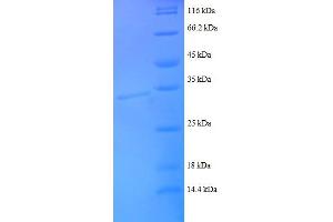 Chemokine (C-C Motif) Ligand 14 (CCL14) (AA 25-82), (partial) protein (GST tag)