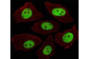 Immunofluorescent analysis of A549 cells using LIN28A antibody at 1:100. (LIN28A 抗体  (AA 108-138))