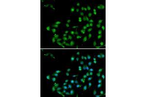 Immunofluorescence analysis of U2OS cells using CTNNBL1 antibody . (CTNNBL1 抗体  (AA 264-563))