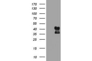 Western Blotting (WB) image for anti-Prenyl (Decaprenyl) Diphosphate Synthase, Subunit 2 (PDSS2) antibody (ABIN1500136) (PDSS2 抗体)