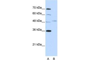 Western Blotting (WB) image for anti-Forkhead Box Q1 (FOXQ1) antibody (ABIN2461966) (FOXQ1 抗体)