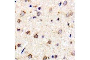 Immunohistochemical analysis of Metaxin-1 staining in rat brain formalin fixed paraffin embedded tissue section. (Metaxin 1 抗体)
