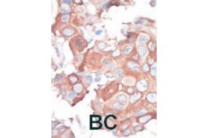 Immunohistochemistry (IHC) image for anti-Mitogen-Activated Protein Kinase Kinase Kinase 1 (MAP3K1) antibody (ABIN3003567) (MAP3K1 抗体)