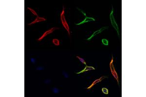ABIN6257250 and ABIN6273924 staining Hela cells by IF/ICC.