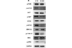 Human KBTBD8 regulated the activity of multiple cell cycle kinases in EOC cells. (MTOR 抗体  (pSer2448))