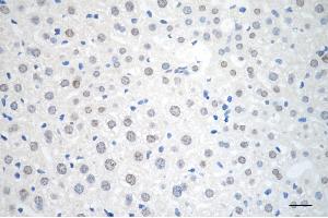 Immunohistochemistry was performed on paraffin-embedded mouse liver using AKAP8 antibody (ABIN7797435), 1:200). (AKAP8 抗体)