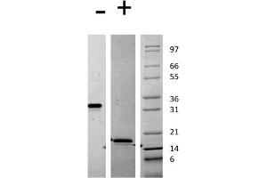 SDS-PAGE of Mouse Platelet Derived Growth Factor AA Recombinant Protein SDS-PAGE of Mouse Platelet Derived Growth Factor-AA Recombinant Protein. (PDGF-AA Homodimer 蛋白)