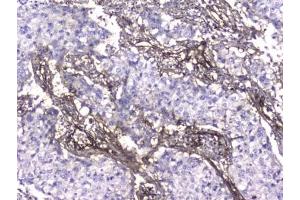 Immunohistochemistry (IHC) image for anti-Collagen, Type IV (COL4) (AA 1445-1669) antibody (ABIN6654107)