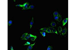 Immunofluorescent analysis of Hela cells using ABIN7176028 at dilution of 1:100 and Alexa Fluor 488-congugated AffiniPure Goat Anti-Rabbit IgG(H+L) (ZC4H2 抗体  (AA 1-224))