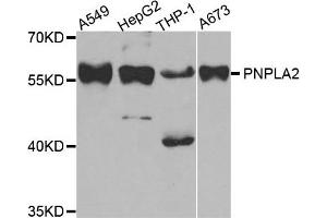 Western Blotting (WB) image for anti-Patatin-Like phospholipase Domain Containing 2 (PNPLA2) antibody (ABIN1882372) (PNPLA2 抗体)