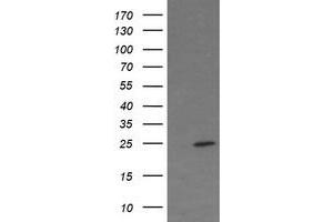 Image no. 3 for anti-Fetal and Adult Testis Expressed 1 (FATE1) antibody (ABIN1498225) (FATE1 抗体)
