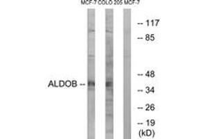 Western blot analysis of extracts from MCF-7/HuvEc cells, using ALDOB Antibody. (ALDOB 抗体  (AA 111-160))