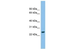 WB Suggested Anti-AK2 Antibody Titration: 0. (Adenylate Kinase 2 抗体  (Middle Region))