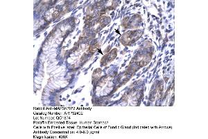 Human Stomach (TAB2 抗体  (N-Term))