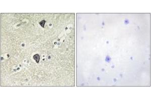 Immunohistochemistry analysis of paraffin-embedded human brain tissue, using FGFR3 Antibody. (FGFR3 抗体  (AA 131-180))