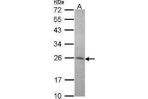 WB Image Sample (30 ug of whole cell lysate) A: Hep G2 , 12% SDS PAGE antibody diluted at 1:1000 (STXBP6 抗体  (N-Term))