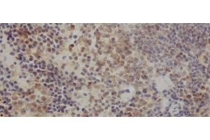 Immunohistochemistry of paraffin-embedded Rat spleen using IL10 Polyclonal Antibody at dilution of 1:50 (IL-10 抗体)