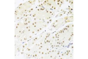 Immunohistochemistry of paraffin-embedded human stomach using RBPJ Antibody (ABIN1876876) at dilution of 1:100 (40x lens). (RBPJ 抗体)