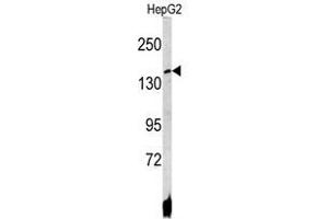 Image no. 1 for anti-ATPase, Cu++ Transporting, beta Polypeptide (ATP7B) (C-Term) antibody (ABIN452773) (ATP7B 抗体  (C-Term))