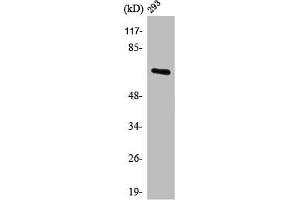 Western Blot analysis of 293 cells using POTE14/22 Polyclonal Antibody (POTEG/POTEH/POTEM (C-Term) 抗体)