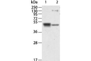 Western Blot analysis of Human kidney and Mouse brain tissue using RAGE Polyclonal Antibody at dilution of 1:750 (RAGE 抗体)