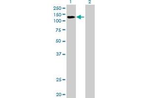 Western Blot analysis of DDX42 expression in transfected 293T cell line by DDX42 MaxPab polyclonal antibody. (DDX42 抗体  (AA 1-819))