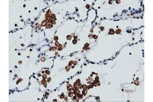 Immunohistochemical staining of paraffin-embedded Human colon tissue using anti-ARHGAP25 mouse monoclonal antibody. (ARHGAP25 抗体)