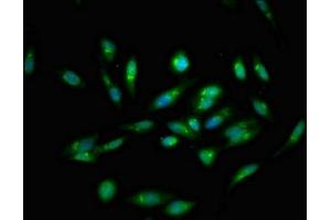 Immunofluorescent analysis of Hela cells using ABIN7146404 at dilution of 1:100 and Alexa Fluor 488-congugated AffiniPure Goat Anti-Rabbit IgG(H+L) (ATP2C1 抗体  (AA 491-605))