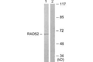 Immunohistochemistry analysis of paraffin-embedded human braIin tissue using DRP-2 (Ab-514) antibody. (DRP2 抗体  (Thr514))