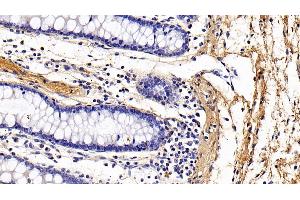 Immunohistochemistry (IHC) image for anti-Collagen, Type I, alpha 1 (COL1A1) (AA 1218-1440) antibody (ABIN7425806)