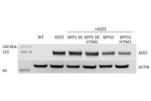 Western Blotting (WB) image for anti-Angiotensin I Converting Enzyme 2 (ACE2) antibody (ABIN1169449)