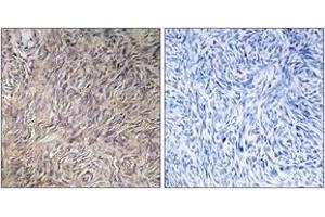 Immunohistochemistry analysis of paraffin-embedded human ovary tissue, using FGF22 Antibody. (FGF22 抗体  (AA 71-120))