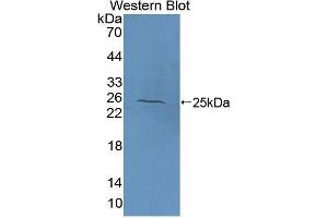 Western Blotting (WB) image for anti-N-Acetylgalactosaminidase, alpha (NAGA) (AA 18-217) antibody (ABIN1176638) (NAGA 抗体  (AA 18-217))