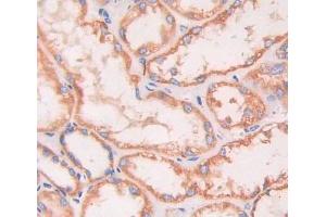 IHC-P analysis of kidney tissue, with DAB staining. (INSRR 抗体  (AA 1090-1295))