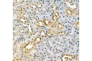 Immunohistochemistry of paraffin embedded mouse kidney using LOXL4 (ABIN7074541) at dilution of 1:400 (400x lens) (LOXL4 抗体)
