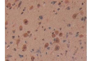 Detection of MYH6 in Rat Brain Tissue using Polyclonal Antibody to Myosin Heavy Chain 6, Cardiac Muscle, Alpha (MYH6)
