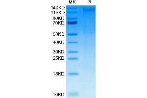 CD248 Protein (AA 18-687) (His tag)