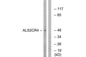 Western Blotting (WB) image for anti-Transmembrane Protein 237 (TMEM237) (Internal Region) antibody (ABIN1850756) (TMEM237 抗体  (Internal Region))