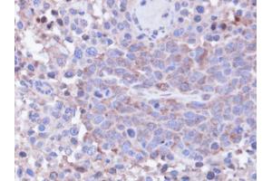 Immunohistochemistry (IHC) image for anti-Protein Phosphatase 1, Catalytic Subunit, gamma Isoform (PPP1CC) (Center) antibody (ABIN2856137)