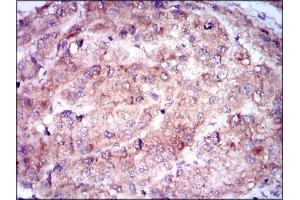 Immunohistochemistry (IHC) image for anti-Enolase 2 (Gamma, Neuronal) (ENO2) (AA 251-433) antibody (ABIN969577)