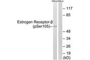 Western blot analysis of extracts from HeLa cells, using Estrogen Receptor-beta (Phospho-Ser105) Antibody. (ESR2 抗体  (pSer105))